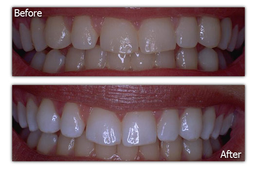 Dental Replacements - Patient 3